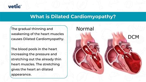 Dilated Cardiomyopathy In Dogs Signs Diagnosis And Treatment