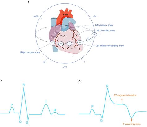 Frontiers Deep Learning For Detecting And Locating Myocardial