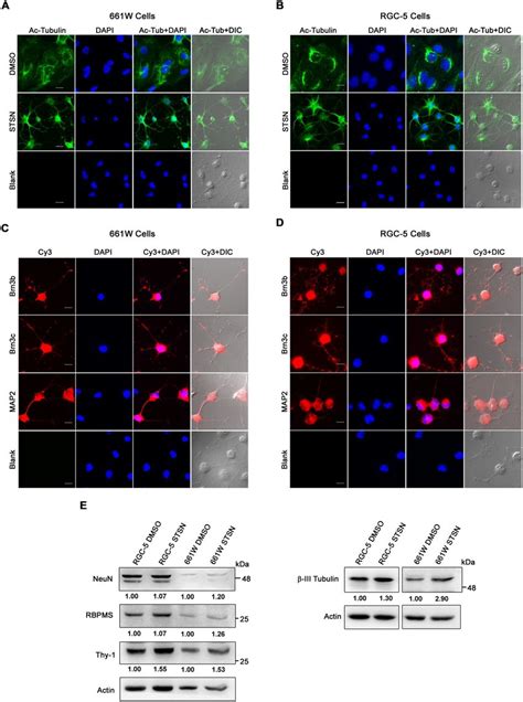 Morphological Analysis And Differentiation Of 661w And Rgc 5 Cells