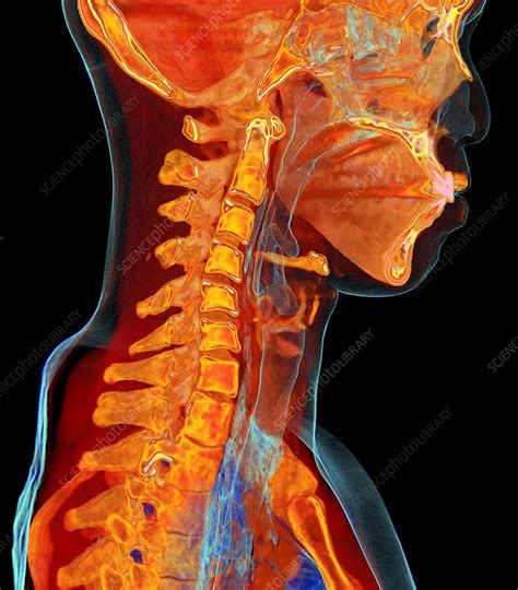 Human Cervical Spine Anatomy D Ct Scan Stock Image C