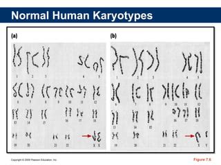 Melc Sex Determination Sex Chromosomes Ppt Explain The Different