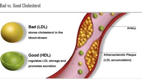 Good Cholesterol Bad Cholesterol