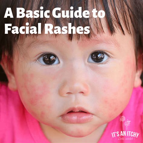 Best Treatments for Facial Rashes | It's an Itchy Little World