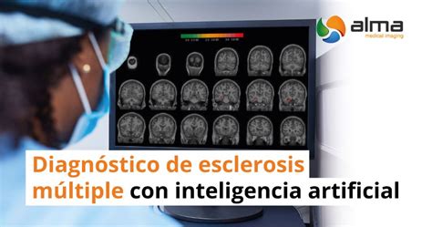 Diagnóstico De Esclerosis Múltiple Con Inteligencia Artificial