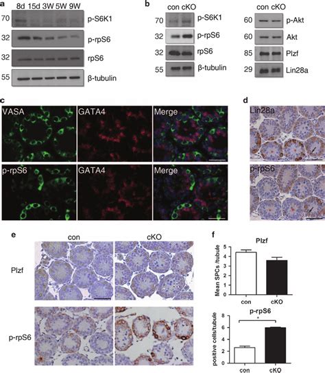 Increased Mtorc Activity In Germ Cells From Lkb Newborn Cko Testis