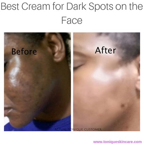 Best Cream for Dark Spots on the Face - Tonique Skincare