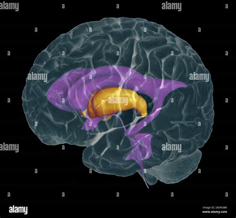 Les Ventricules Du Cerveau Composite De Couleur D Imagerie Par