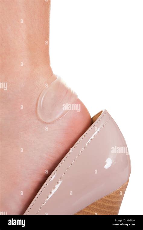 Blister Foot Hi Res Stock Photography And Images Alamy