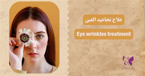 Eye wrinkles treatment in Hurghada | Book now | Nadara Clinic