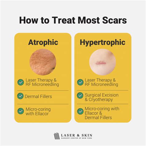 Best Treatments For All Types Of Scars Explained Laser Ny