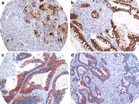 Examples Of Immunohistochemical Staining Of Muc1 ×200 A Muc2 ×200 Download Scientific