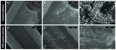 Scanning electron microscopy micrographs of each type of catheter after ... 