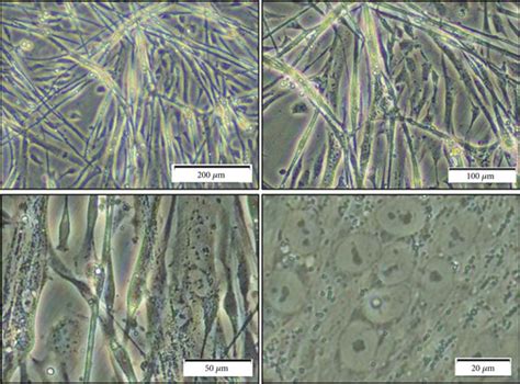 Global Gene Expression Analysis Of Esc Derived Mesenchymal Stromal