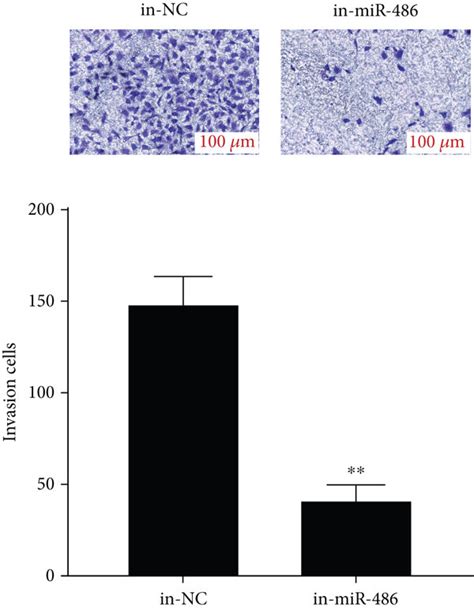 Interference With Mir 486 Expression Inhibits The Biological Function