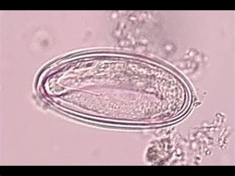 10 Enterobius vermicularis MORFOLOGÍA Y DIAGNÓSTICO DE PARASITOSIS