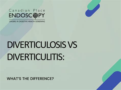 Ppt Diverticulosis Vs Diverticulitis Whats The Difference