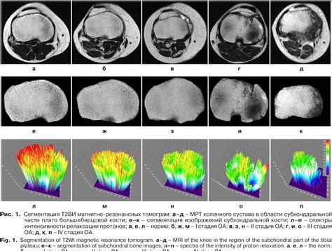 Figure 1 From The Possibilities Of Magnetic Resonance Imaging In The