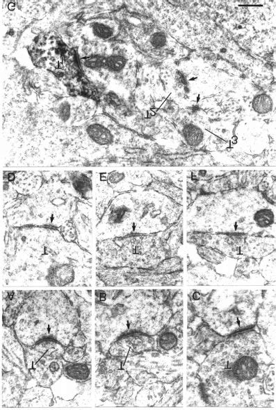 Electron micrographs showing synaptic junctions (arrows) in the... | Download Scientific Diagram