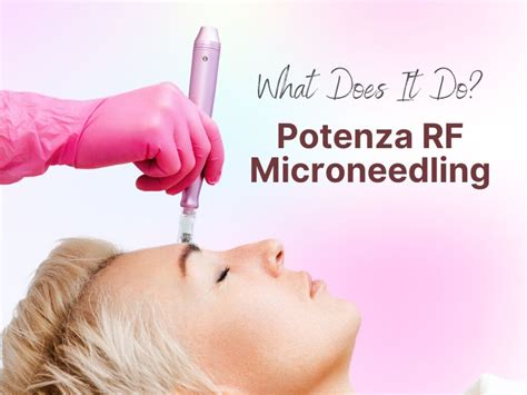 What Does Potenza Rf Microneedling Do Is It Worth It