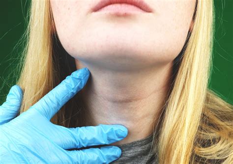 Covid Patients May Be Susceptible To Developing Subacute Thyroiditis