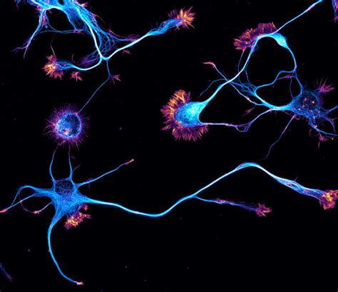 Rat Hippocampal Neurons Microtubules And Actin Nikon Small World