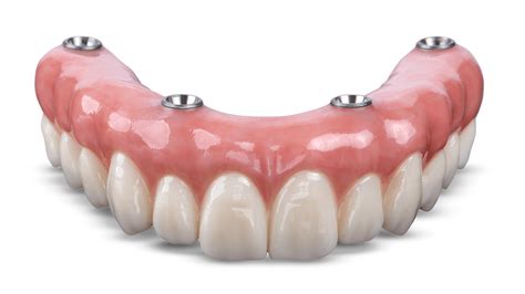 Zirconia Crown - BruxZir® Zirconia Crowns and Bridges