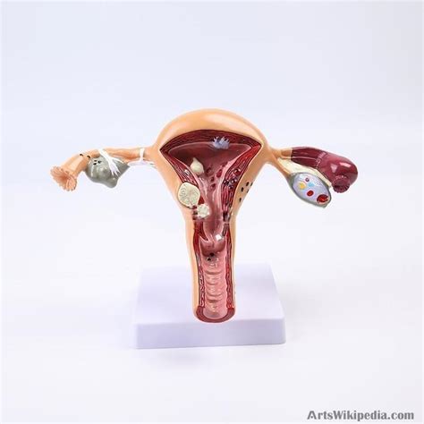 Anatomical Pathological Uterus Ovary Model Anatomy Medical Organ Model