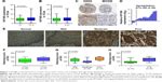 Kif B Promotes Tumor Progression Through Activating The Wnt Beta Cate