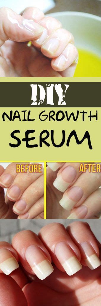 Diy Nail Strengthener Top 5 Diy