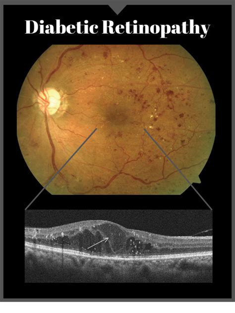 Digital Retinal Imaging Greenfield Optometry