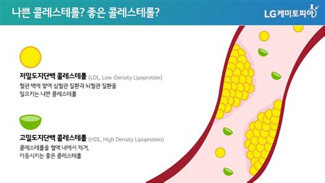 고지혈증 LDL 나쁜 콜레스테롤 HDL 좋은 콜레스테롤 TG 중성지방 이란 단어 정리 a2