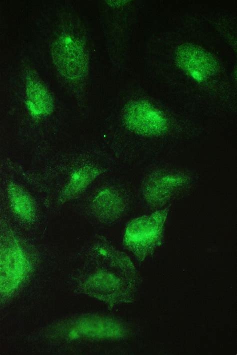 Anti Cct Cct Beta Antibody Rabbit Anti Human Polyclonal Ihc Wb Lsbio