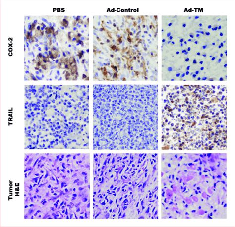 Immunohistochemical Staining For Cox And Trail And Pathologic