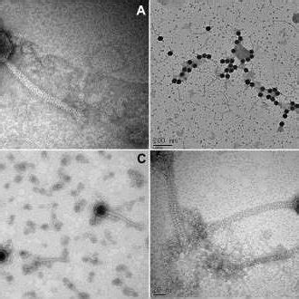 Electron Micrographs Of Mfv Particles Negatively Stained With