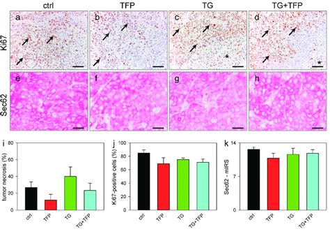 Immunohistochemical Stainings Of Fadu Cell Tumors 35 Days After