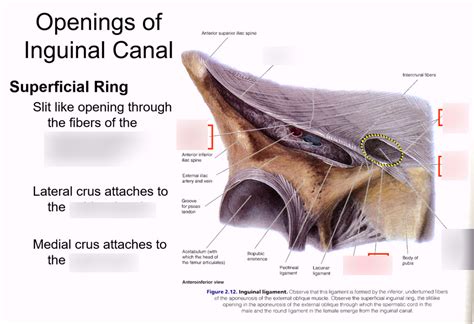 Superficial Inguinal Ring Cadaver