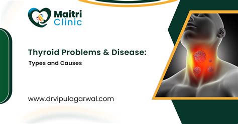 Thyroid Problems And Disease Types And Causes By Dr Vipul Agarwal