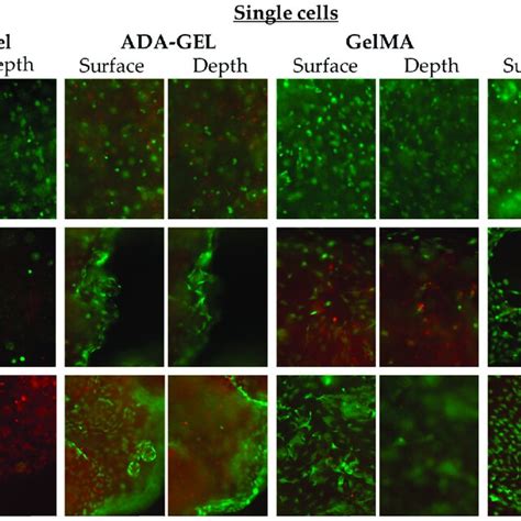 Single Cells On Days 1 7 And 14 In Alghagel Ada Gel Gelma And