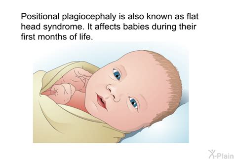 Positional Plagiocephaly