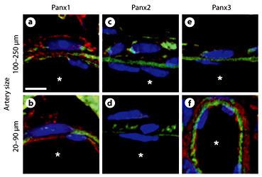 Panx Expression In The Coronary Arteries Coronary Arteries That Were