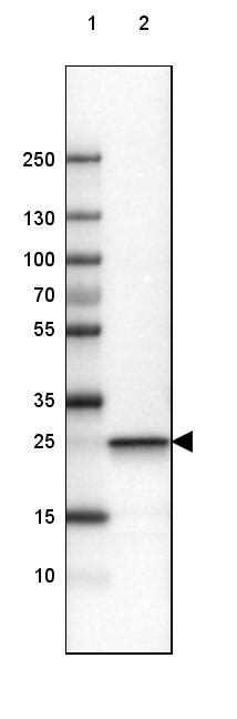 Anti Uchl Antibody Ul Igg Clone Cl Unconjugated Mouse