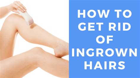 Ingrown Hair On Legs Women