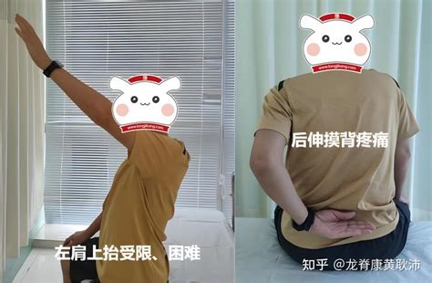 肩痛手抬不起来肩周炎如何康复治疗呢请看此文 知乎