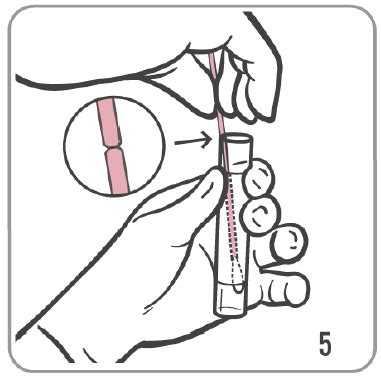 Rectal Swab Specimen Collection