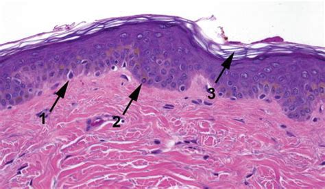 Melanocyte Histology