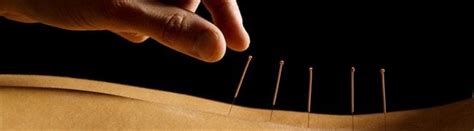 Dry Needling Vs Acupuncture How To Tell The Difference — Albany Street Clinic