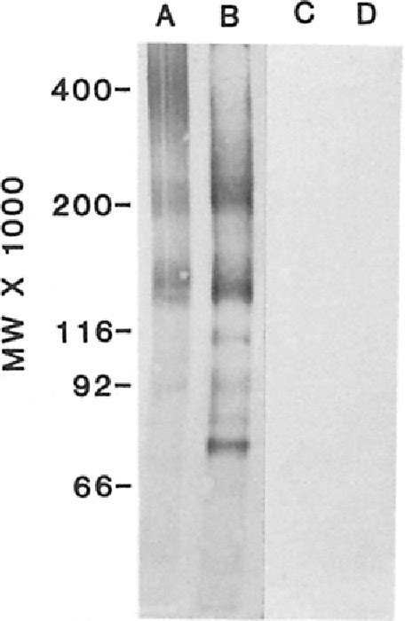 Figure From Glomerular Basement Membrane Proteoglycans Are Derived