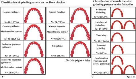 The Classification Of Grinding Activities In Sleep Bruxism And Their Download Scientific