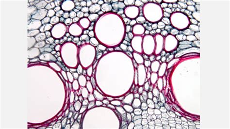 Parenchyma Cells Slide