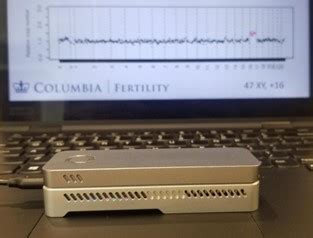 Aneuploidy Detection by Nanopore Sequencing - Bioinformatics Hub